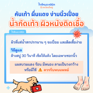 คันเท้า ผื่นขึ้น น้ำท่วม